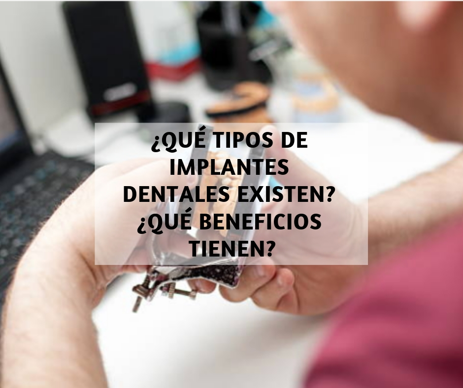 ¿Qué tipos de implantes dentales existen? ¿qué beneficios tienen?