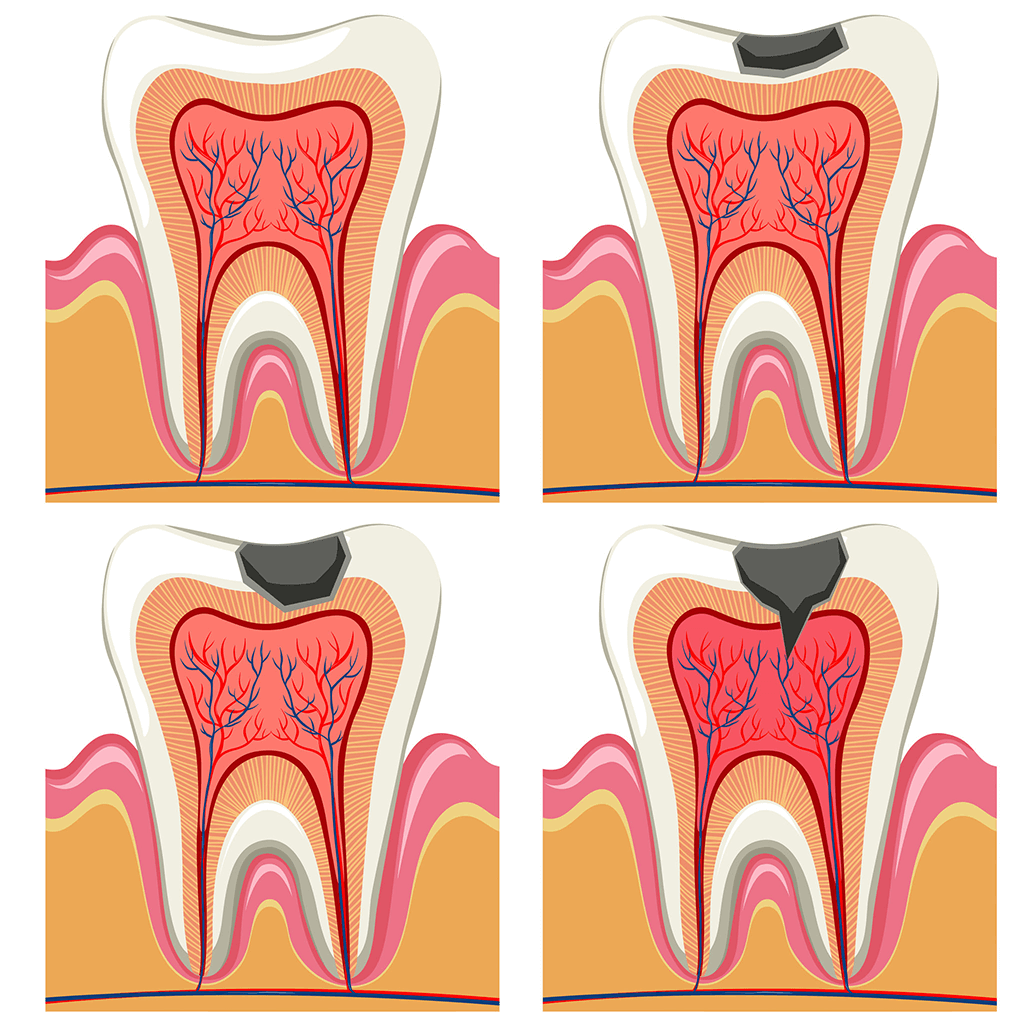 Odontología conservadora Endodoncia