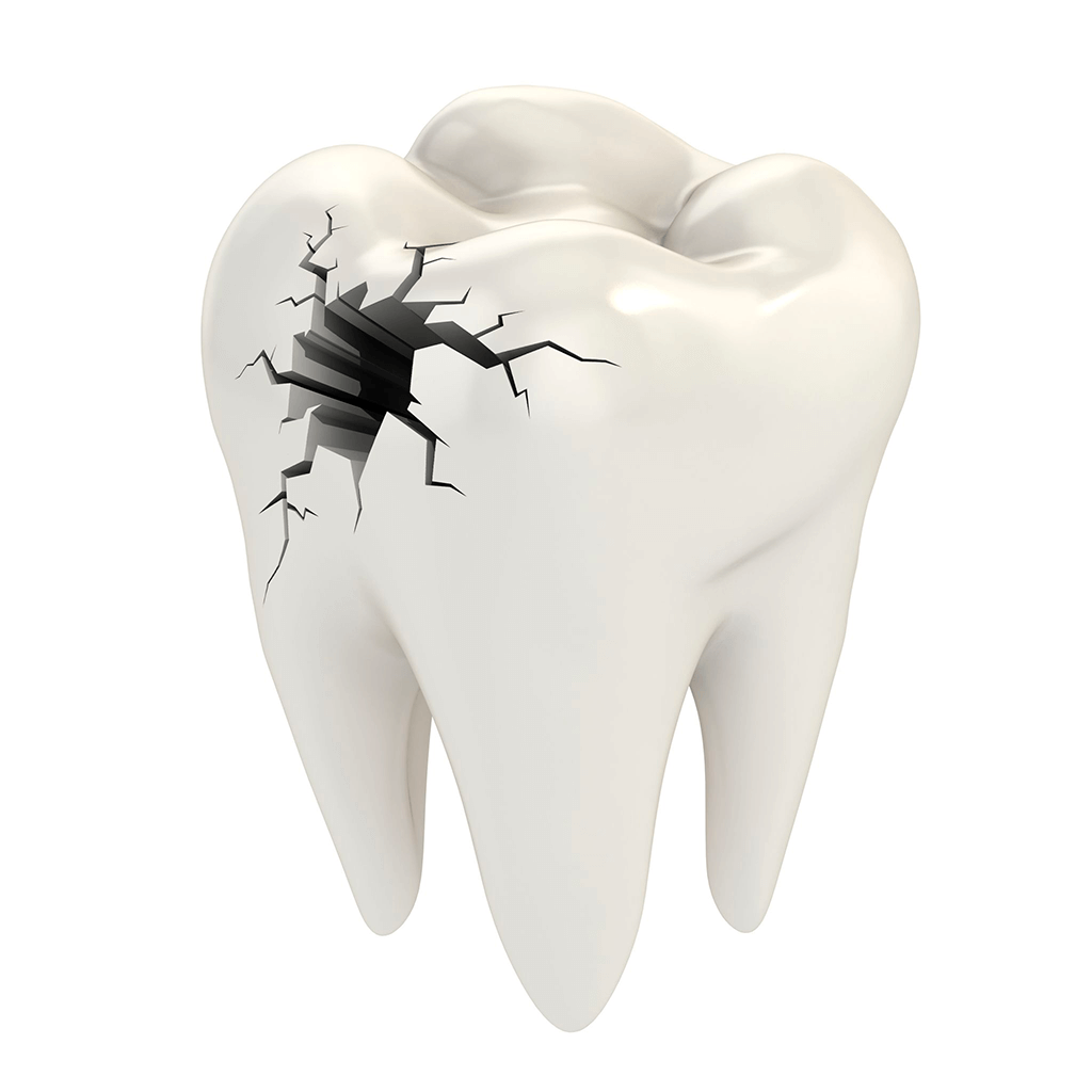 Odontologia Conservadora Estetica Madrid