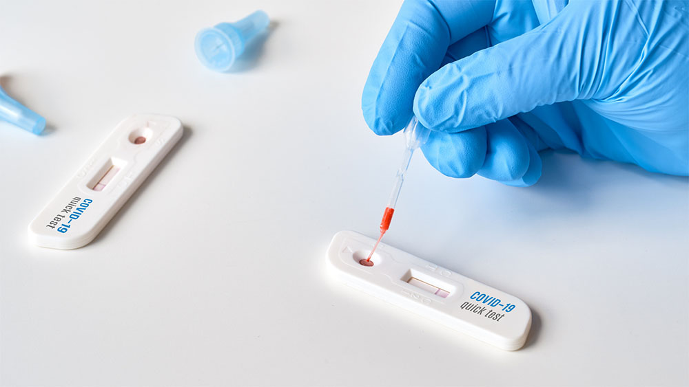 Test Rapido PCR Covid19 Madrid