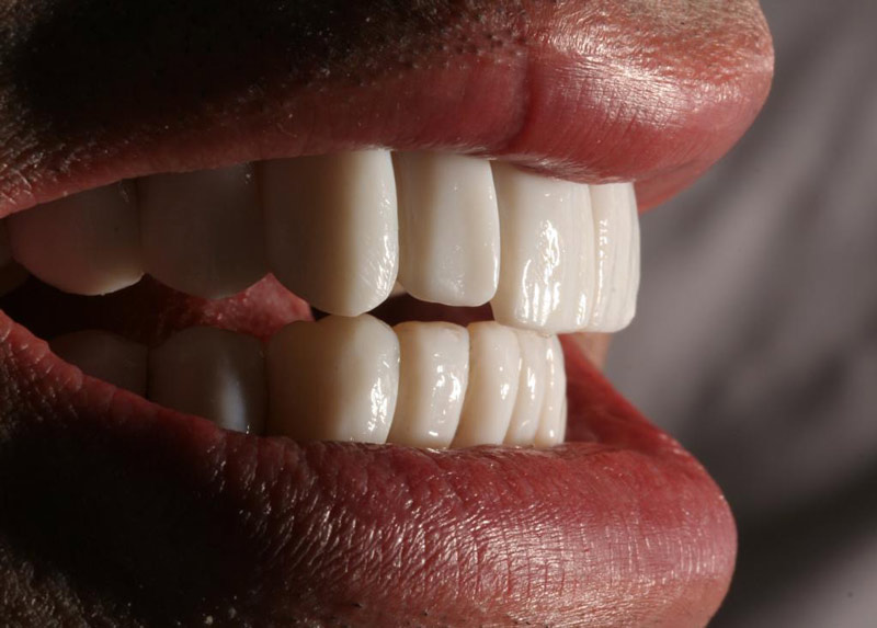 tratamiento antiaging dental rejuvenecimiento